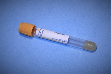 Gold serum separator (SST) tube